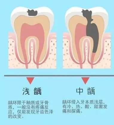 小度蚂蚁牙是什么_蚂蚁庄园牙膏_牙齿出现小白点蚂蚁庄园