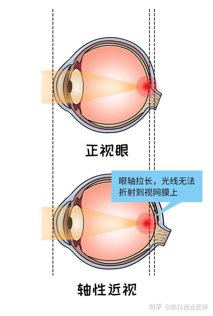 反转玩手机游戏怎么玩_反转玩手机游戏软件_手机玩游戏不反转