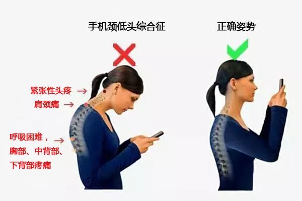 手机玩游戏对眼睛损害_眼睛损害玩手机游戏有用吗_眼睛损害玩手机游戏有影响吗