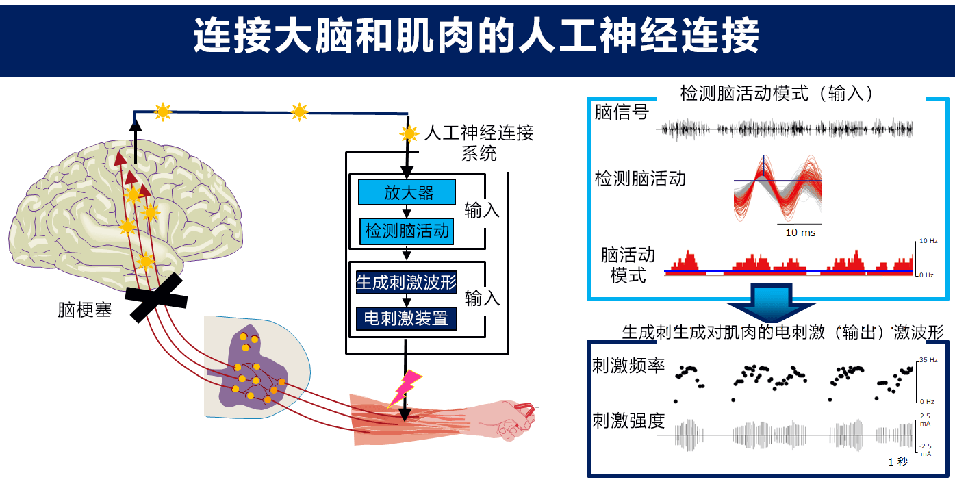安吉拉脑叶公司立绘_脑叶公司安吉拉_安吉拉脑叶公司cos