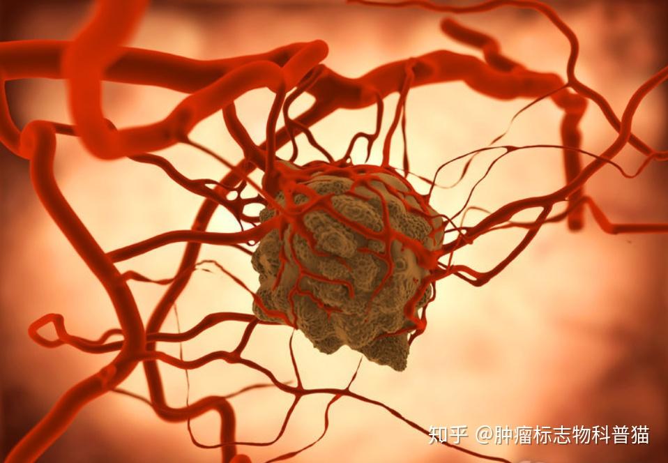 知乎上海海得_手机玩游戏会得肿瘤吗知乎_肿瘤病人玩手机有影响吗