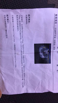 记录宫缩app哪个好用_记录宫缩软件_记录宫缩的app
